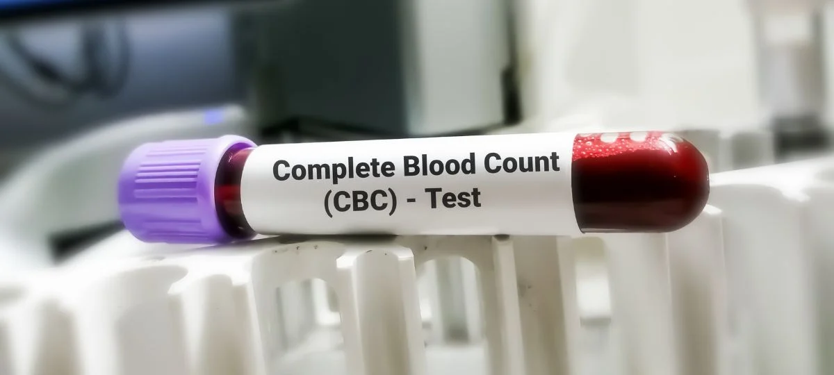 CBC Test