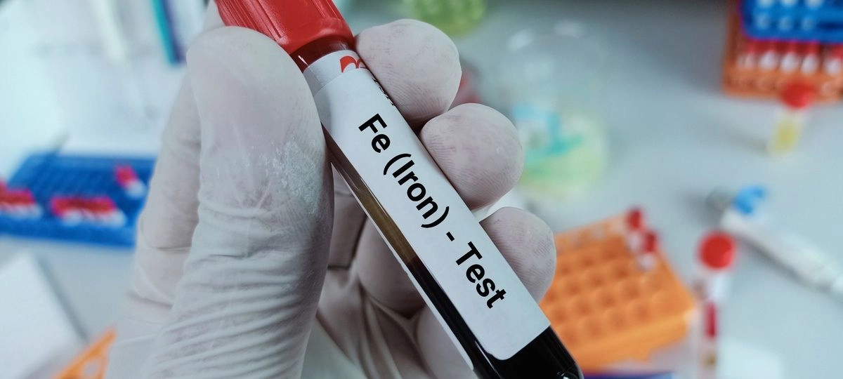 How Blood Tests Detect Different Types of Anemia